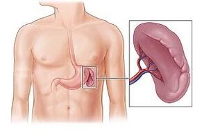 patologia splinei ca cauză a durerii sub omoplatul stâng