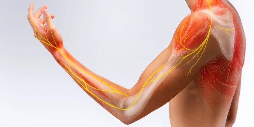 Durerea și amorțeala degetelor indică deteriorarea ligamentelor din cauza ligamentitei stenosante