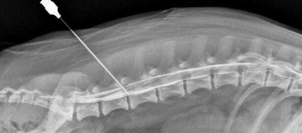 blocarea coloanei vertebrale cu osteocondroză